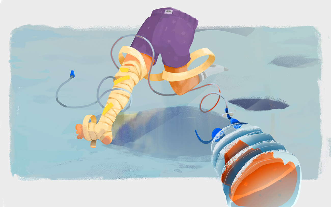 jakubsvehla-postsurgery